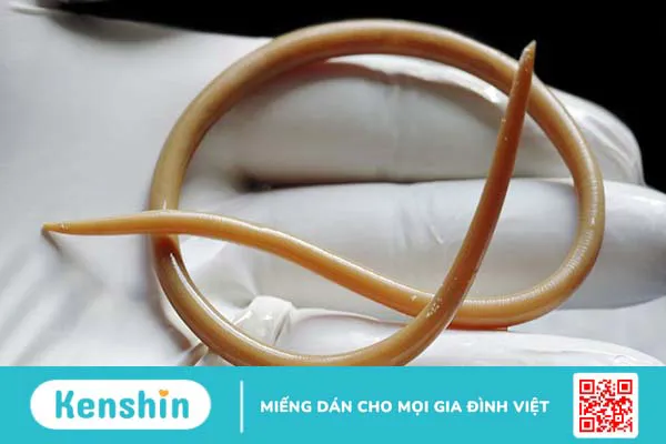 Các dấu hiệu nhiễm ký sinh trùng và quá trình chẩn đoán