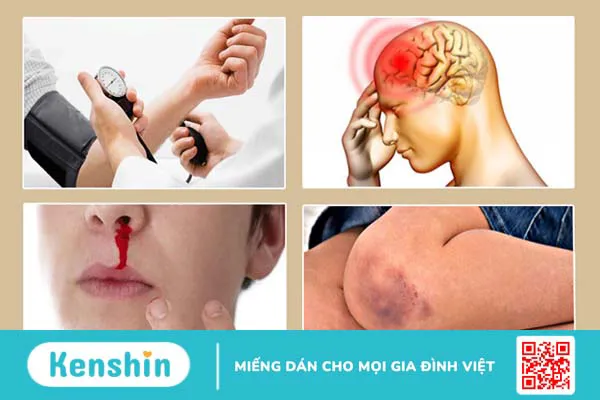 Các giai đoạn sốt xuất huyết và cách xử lý an toàn, hiệu quả