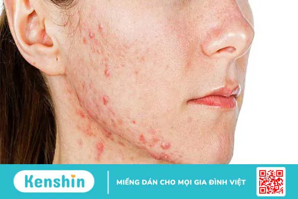 Các hoạt chất không dùng chung với Serum Vitamin C và lưu ý