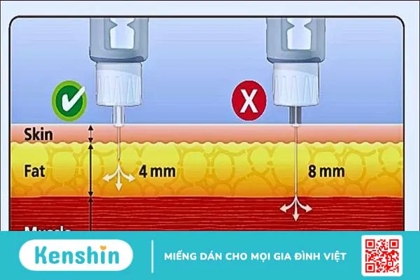 Các loại bút tiêm insulin thường dùng, hướng dẫn lựa chọn và cách dùng