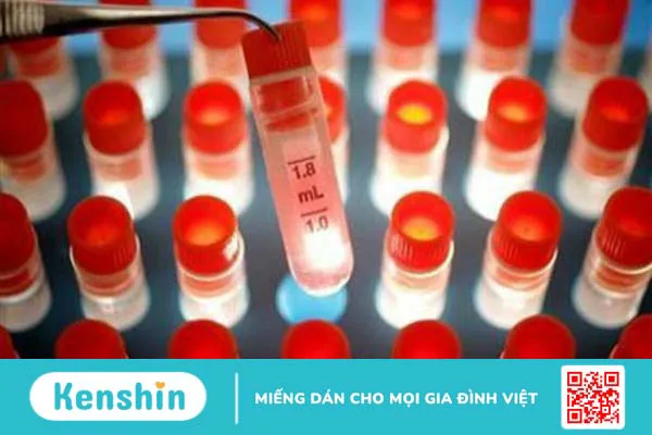 Các phương pháp điều trị viêm gan B phổ biến hiện nay