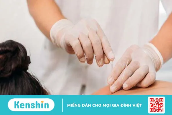 Các tác dụng của phương pháp châm cứu trong chữa bệnh