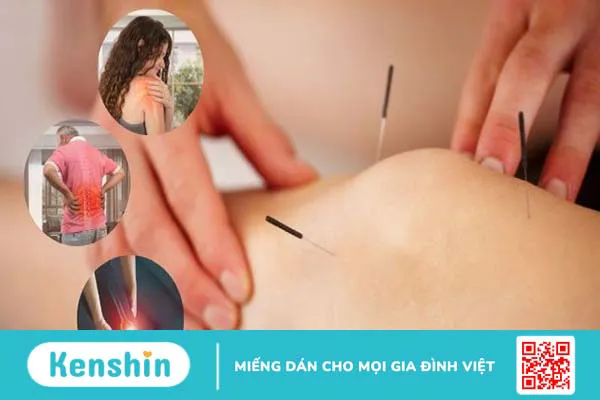 Các tác dụng của phương pháp châm cứu trong chữa bệnh