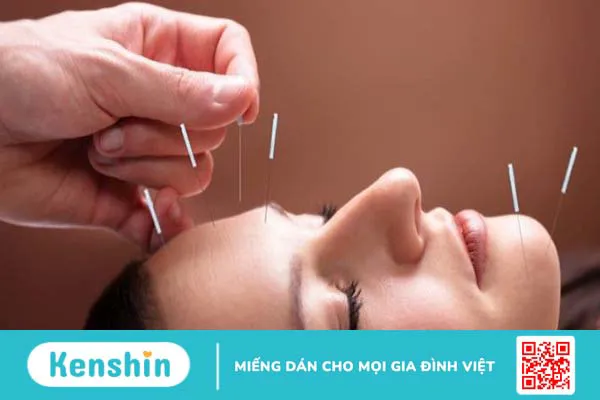 Các tác dụng của phương pháp châm cứu trong chữa bệnh