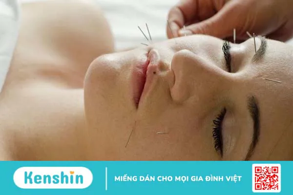 Các tác dụng của phương pháp châm cứu trong chữa bệnh