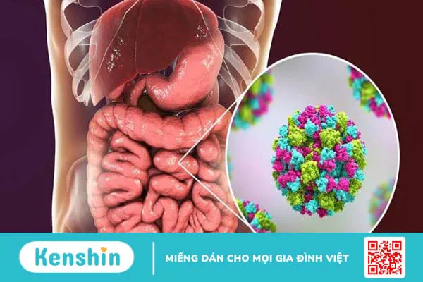 Các triệu chứng rối loạn tiêu hóa dễ nhận biết và thực phẩm nên ăn