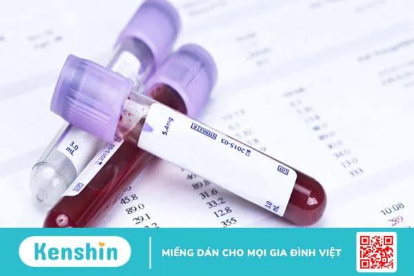 Các xét nghiệm để chẩn đoán tiểu đường