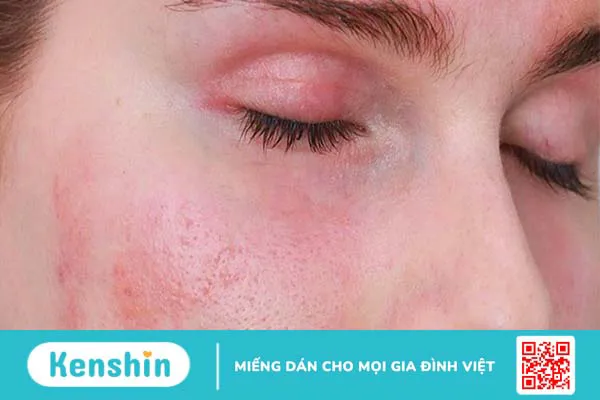 Cách chăm sóc da mặt phù hợp cho từng loại da và lưu ý khi dưỡng da