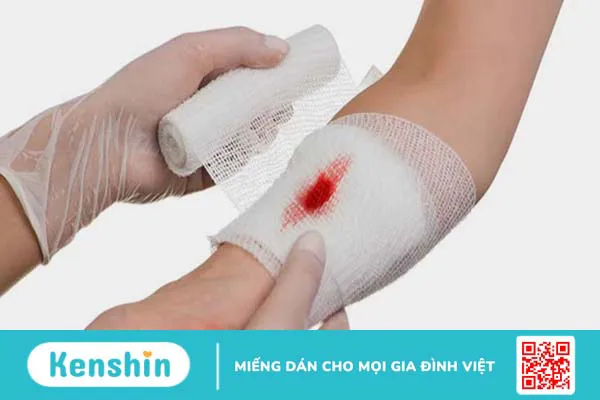 Cách chăm sóc vết thương mau lành, không để lại sẹo