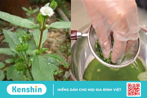 Cách chữa trị và phòng ngừa nhiệt miệng hiệu quả