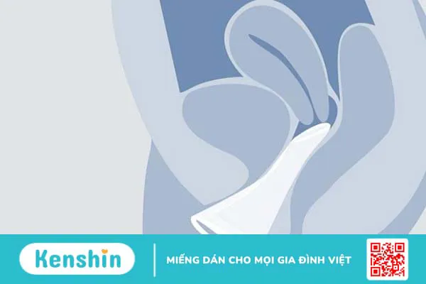 Cách dùng bao cao su cho nam giới và nữ giới