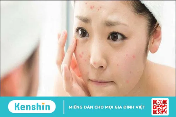 Cách dùng dầu tẩy trang làm sạch sâu cho da hiệu quả không nổi mụn