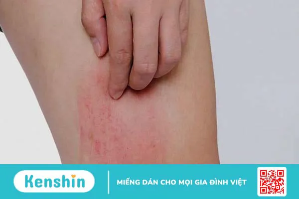 Cách dùng, lưu ý khi sử dụng Bồ công anh