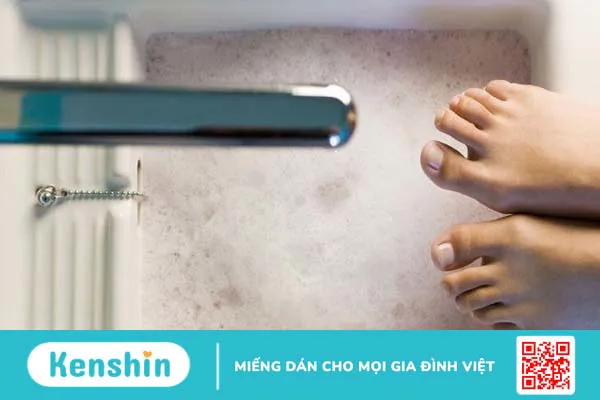 Cách dưỡng móng chân bị hư tại nhà giúp móng nhanh mọc lại