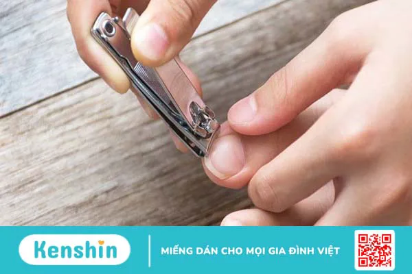 Cách dưỡng móng chân bị hư tại nhà giúp móng nhanh mọc lại