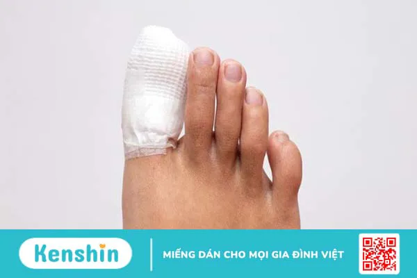 Cách dưỡng móng chân bị hư tại nhà giúp móng nhanh mọc lại