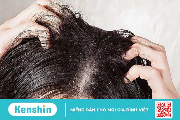 Cách gội đầu đúng cách, chuẩn salon giúp giảm gãy rụng