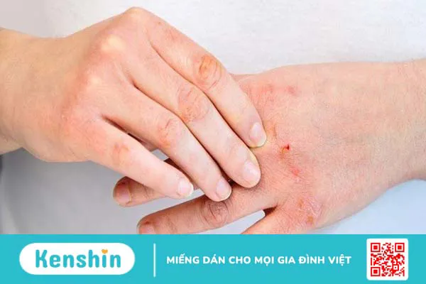 Cách làm nước rửa tay sát khuẩn tại nhà