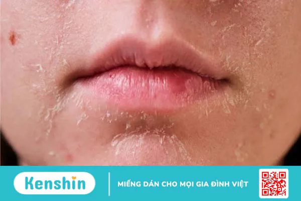 Cách lựa chọn và hướng dẫn sử dụng retinol đảm bảo an toàn hiệu quả