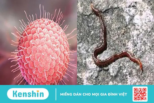 Cách phân biệt bệnh zona thần kinh và giời leo