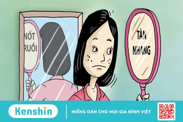 Cách phân biệt tàn nhang và nốt ruồi