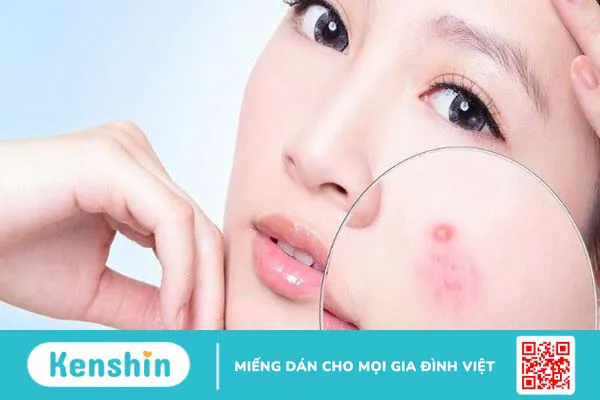 Cách rửa mặt bằng nước vo gạo để có làn da trắng hồng rạng rỡ