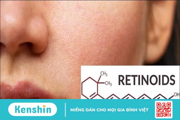 Cách rửa mặt đúng cách cho da mụn giúp nhanh hồi phục và giảm thâm