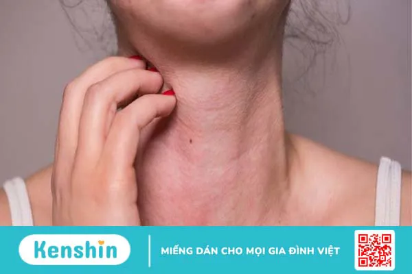 Cách sử dụng cây bồ công anh đúng cách an toàn và hiệu quả