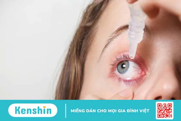 Cách sử dụng thuốc nhỏ mắt đúng cách khi trị tăng nhãn áp