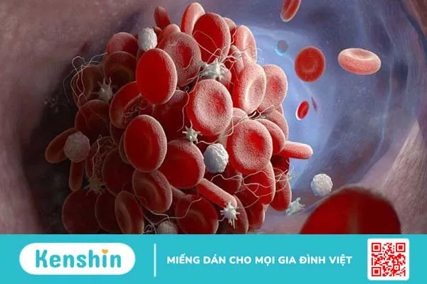 Cách thức COVID-19 tấn công mọi cơ quan nội tạng