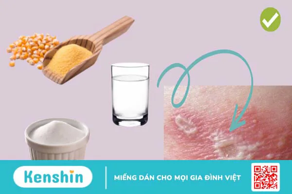 Cách trị giời leo tại nhà an toàn giúp bạn nhanh khỏi bệnh