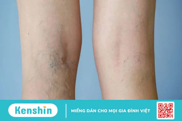 Cách xác định dáng người chuẩn xác cho nữ và 5 kiểu dáng người cơ bản