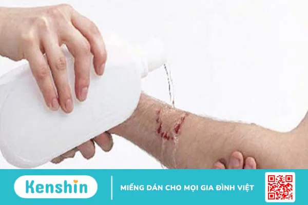 Cách xử lí khi bị bệnh dại