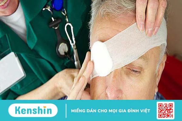 Cách xử lí khi bị chấn thương mắt