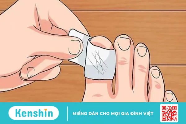 Cách xử lý móng chân bị hư an toàn, hiệu quả, tránh nhiễm trùng