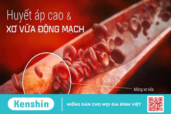 Cải bó xôi có tác dụng gì? 13 tác dụng của cải bó xôi có thể bạn chưa biết