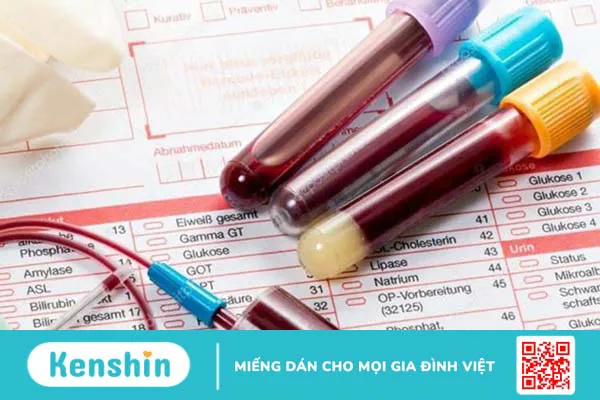 Cảnh báo 3 nguyên nhân viêm tụy cấp điển hình không thể chủ quan