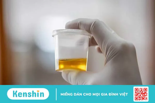 Cảnh báo 6 triệu chứng sỏi bàng quang điển hình bạn cần lưu ý