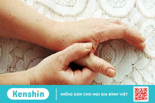 Cảnh báo 7 triệu chứng thoái hóa khớp điển hình không thể chủ quan