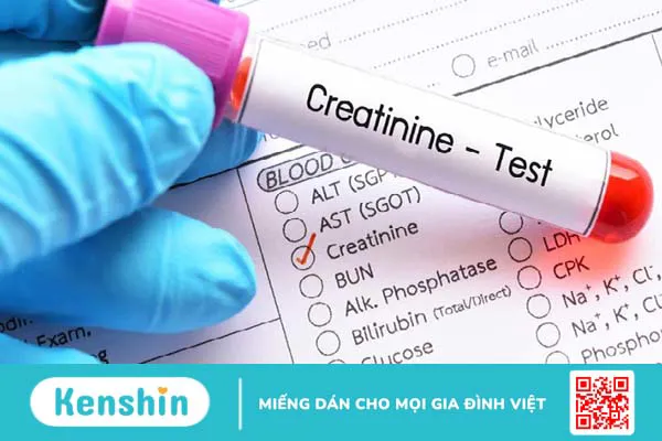 Cảnh báo 8 dấu hiệu sỏi thận có thể bạn chưa biết