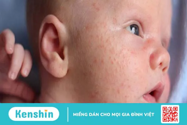 Cảnh báo: Cây kim tiền có độc tố nguy hiểm, nhà có em bé nên cẩn thận