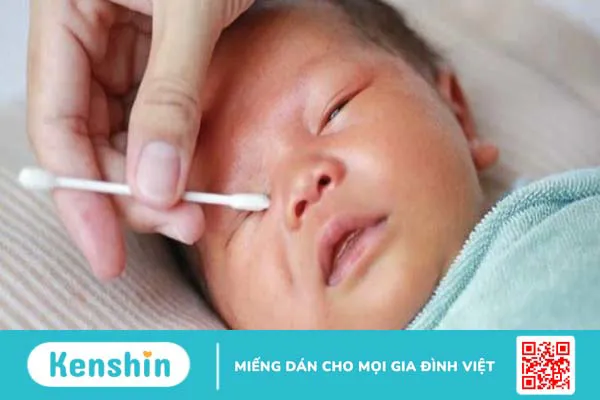 Cảnh báo nguy hiểm khi nhỏ sữa mẹ trực tiếp vào mắt của trẻ sơ sinh