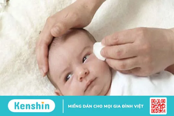 Cảnh báo nguy hiểm khi nhỏ sữa mẹ trực tiếp vào mắt của trẻ sơ sinh