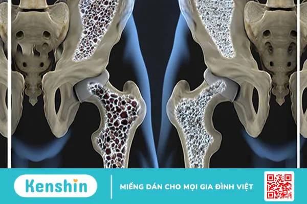 Canxi là gì? Công dụng, cách dùng, thực phẩm chứa canxi