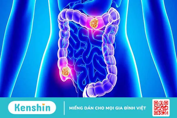 Canxi là gì? Công dụng, cách dùng, thực phẩm chứa canxi