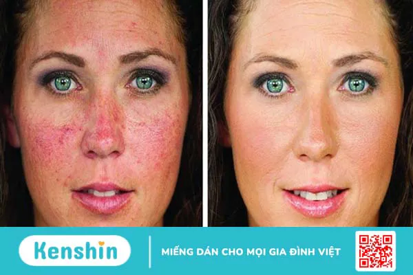 Carotenoid là chất gì? Công dụng, cách dùng, thực phẩm chứa carotenoid