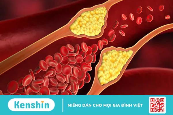 Cây chùm ngây là gì? 4 tác dụng của cây chùm ngây đối với cơ thể