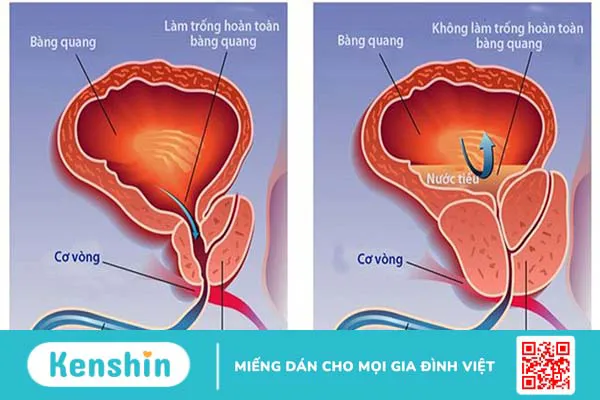 Cây chùm ngây là gì? 4 tác dụng của cây chùm ngây đối với cơ thể