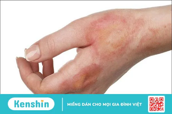 Cây dừa cạn có tác dụng gì? Mách bạn 9 tác dụng của cây dừa cạn