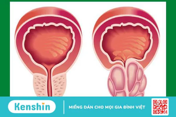 Cây dừa cạn có tác dụng gì? Mách bạn 9 tác dụng của cây dừa cạn